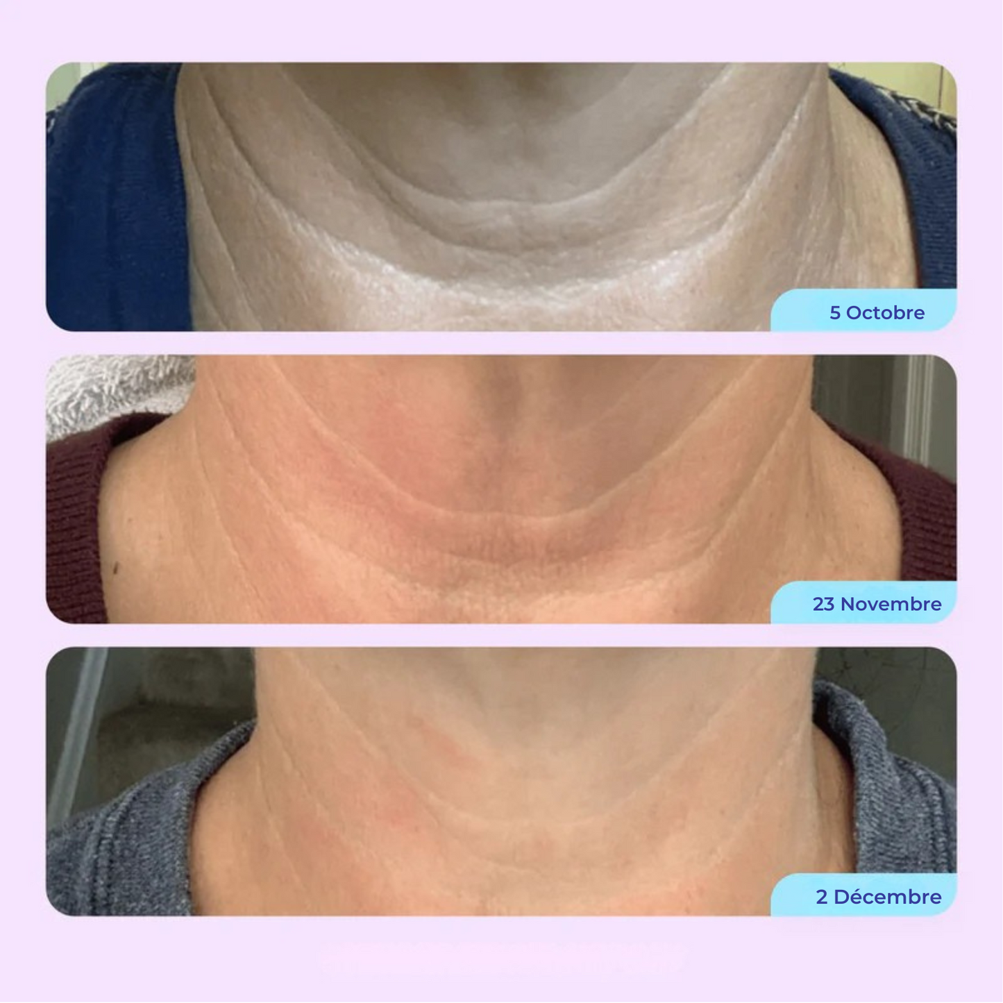 SmoothLift™ Complex — Kalmeris Beauty