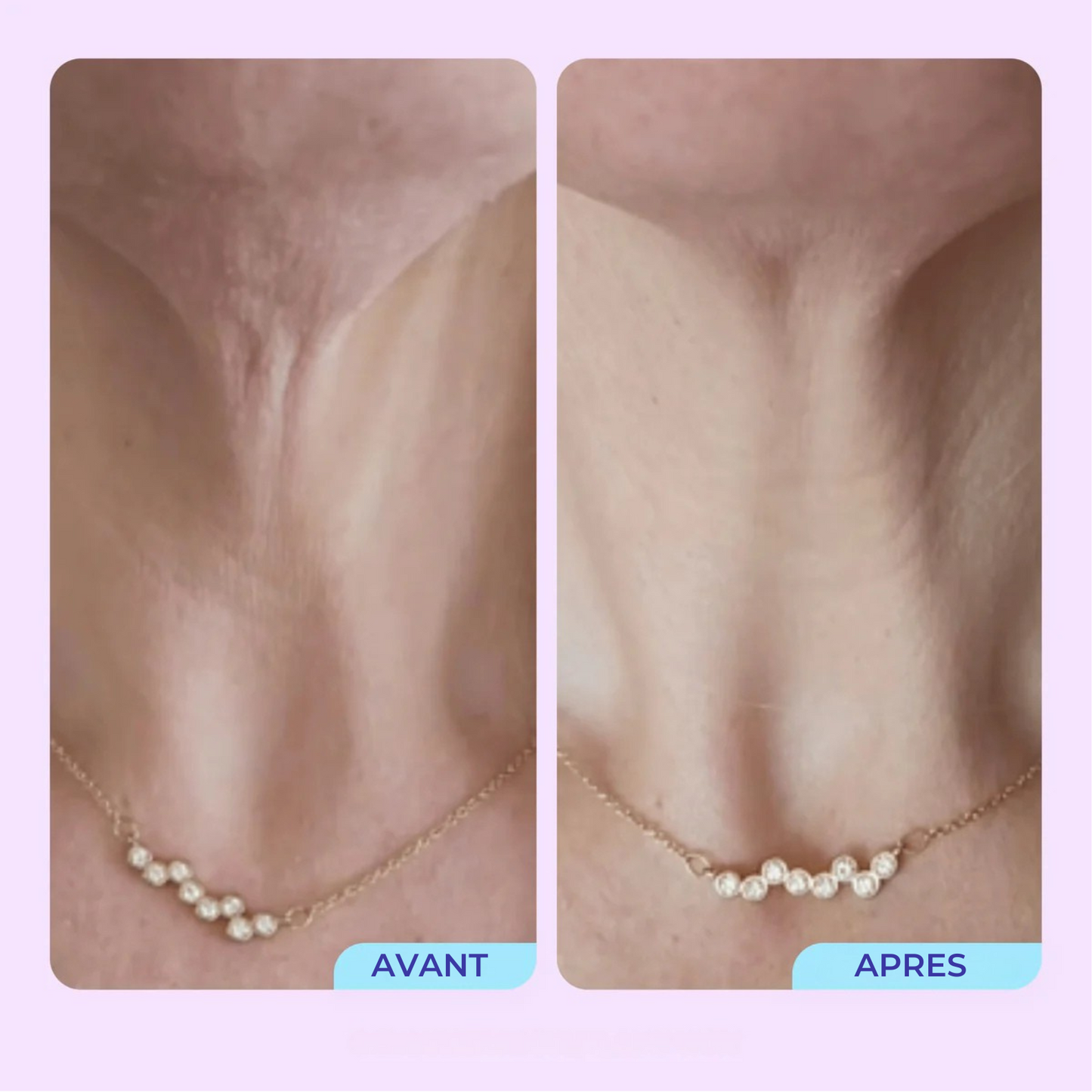 SmoothLift™ Complex — Kalmeris Beauty