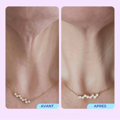 SmoothLift™ Complex — Kalmeris Beauty
