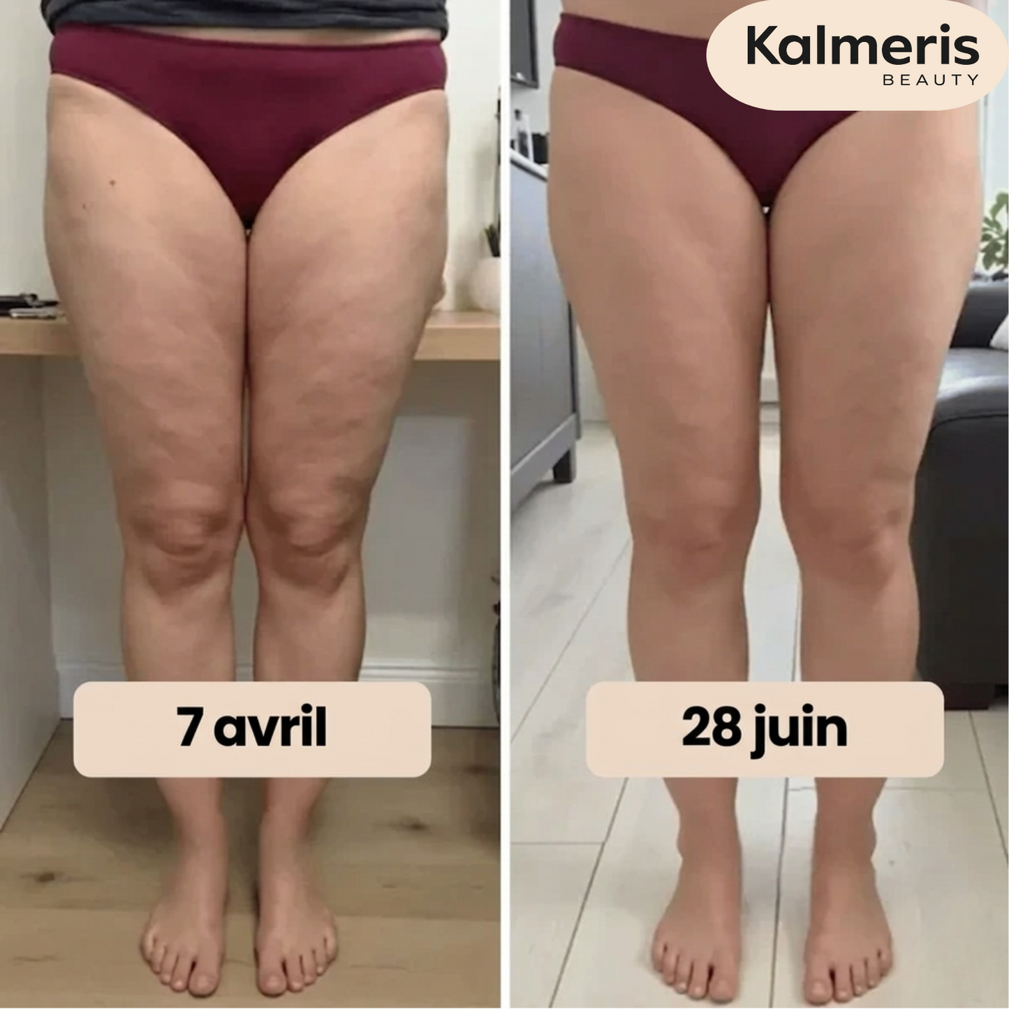 Leggings 3D - Kalmeris Beauty™
