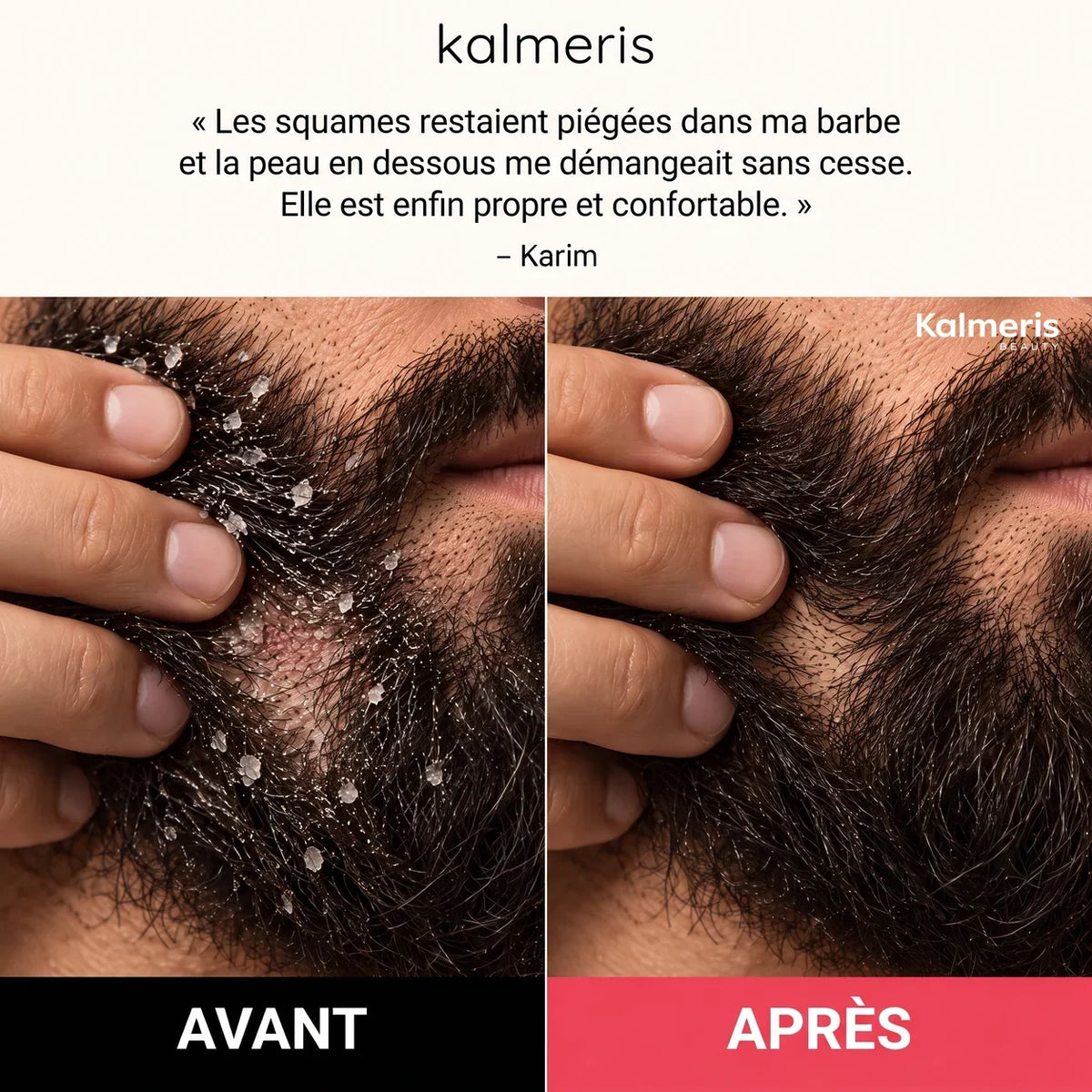 Gommage barbe et cuir chevelu 4
