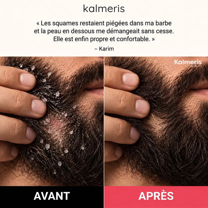 Gommage barbe et cuir chevelu 4