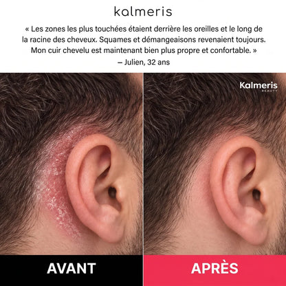 Gommage barbe et cuir chevelu 5